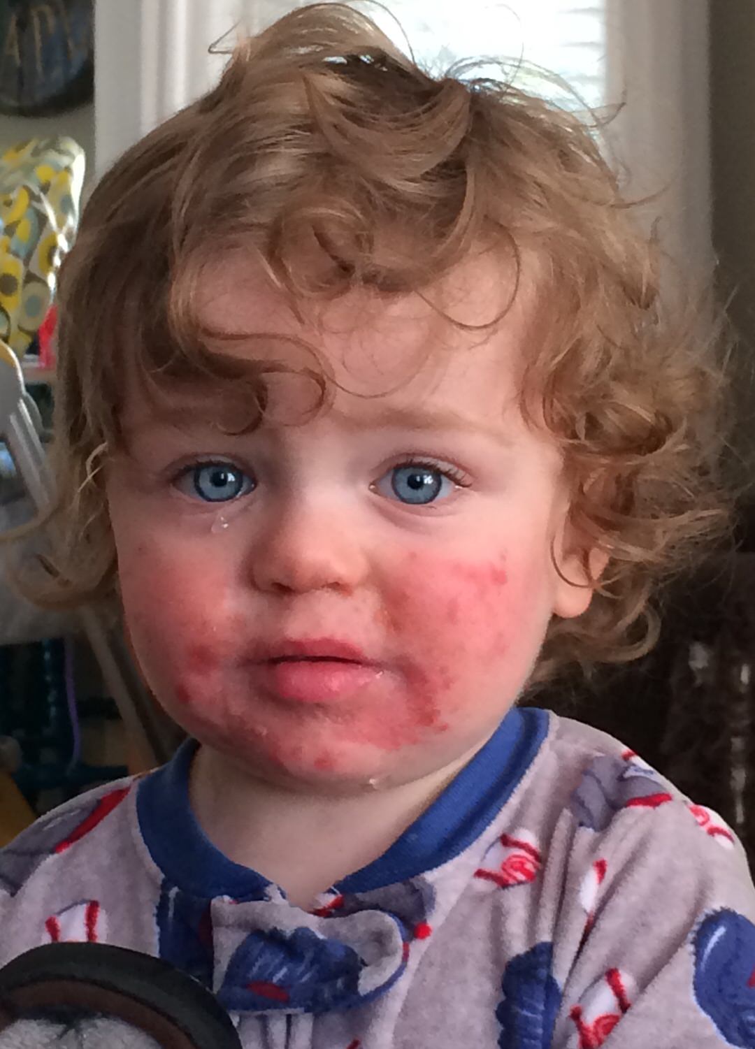 Enfant érythème infectieux